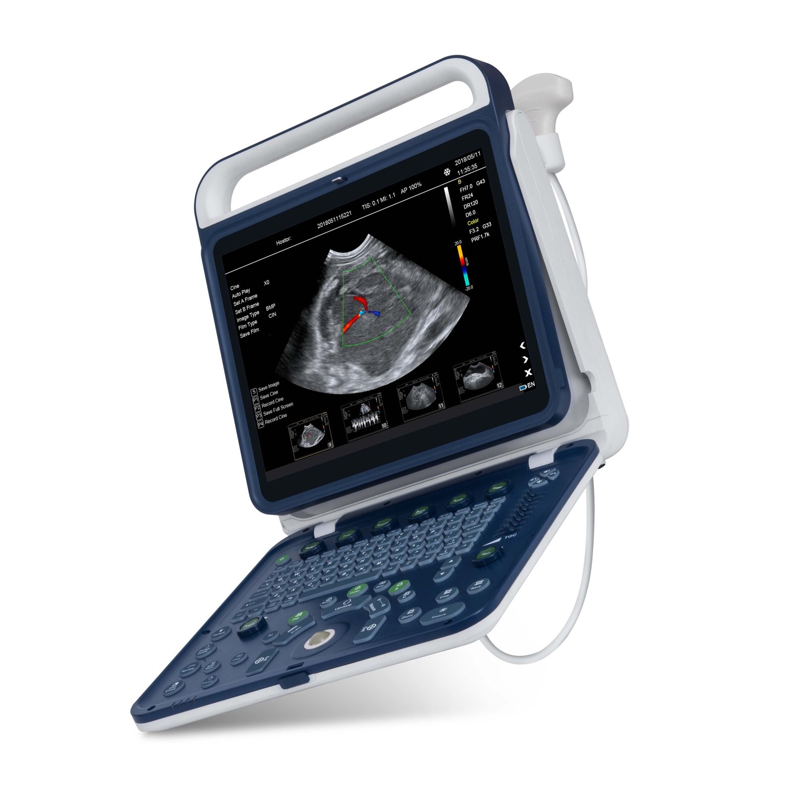 Hand Carried Color Doppler Ultrasound Machine For Vet MDLVU41