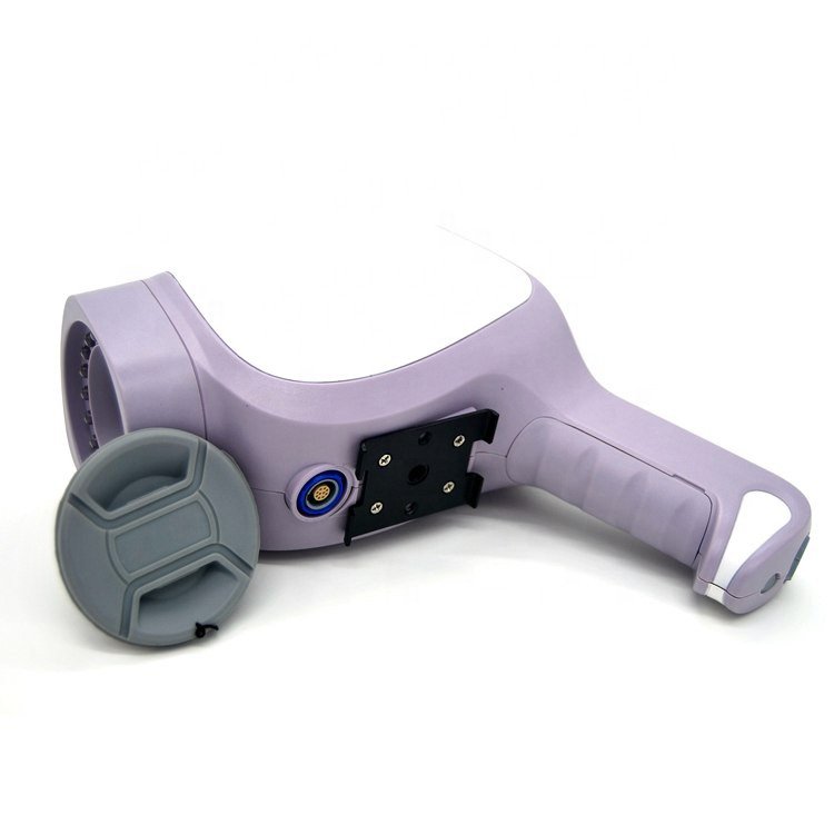 Portable Gynaecology Digital Colposcope System MDLCE07