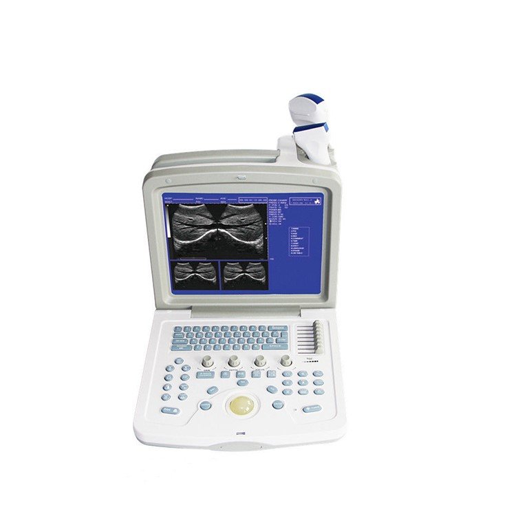 CMS600B3 B-Ultrasound Diagnostic System