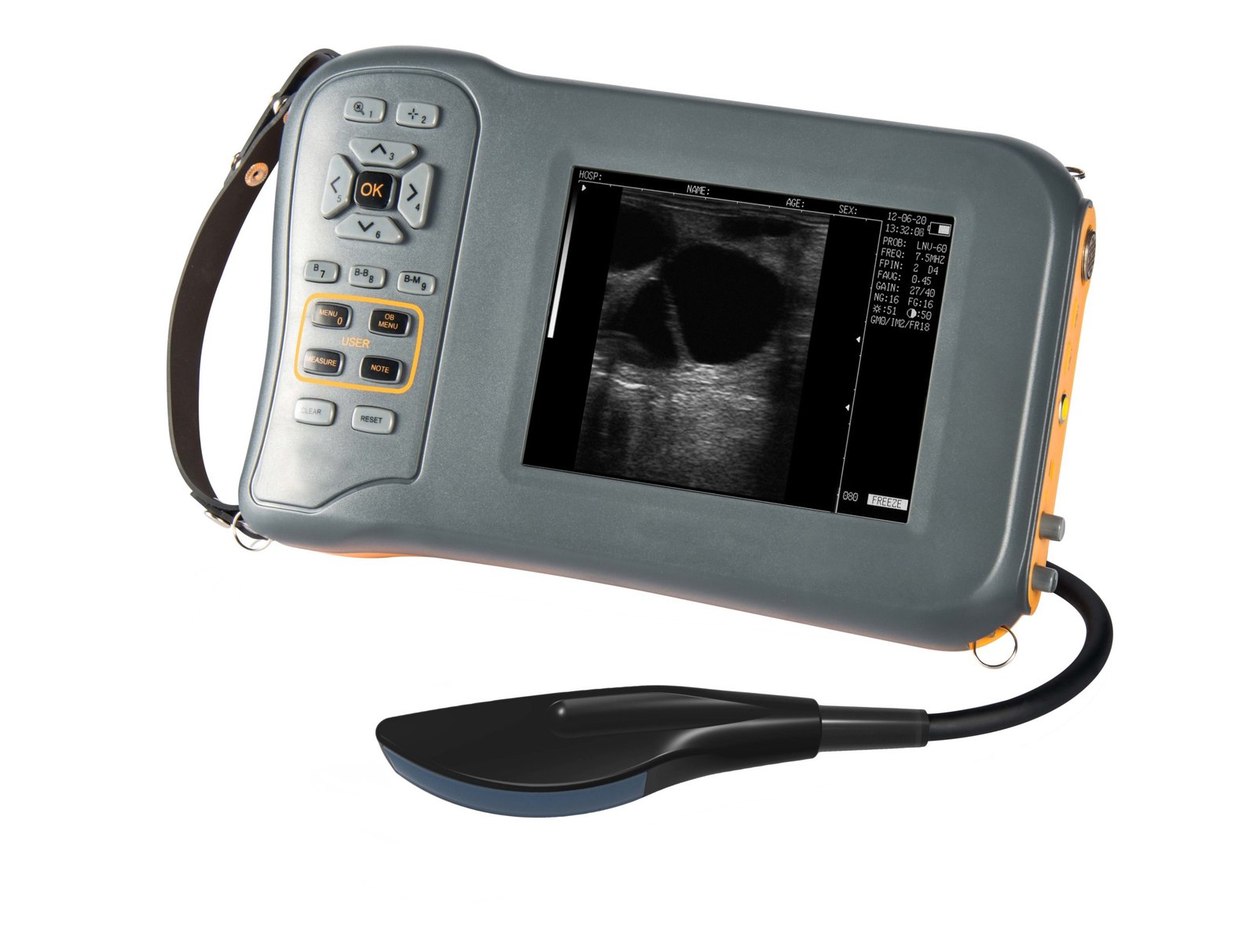 Mini Portable Veterinary Black and White Ultrasound Machine MDLVU42