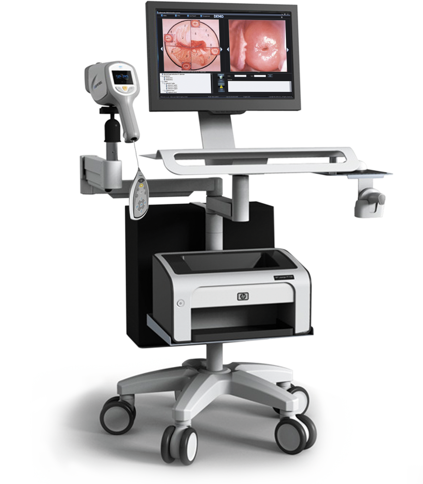 Multi-functional Trolley Colposcope Video Machine MDLCE08
