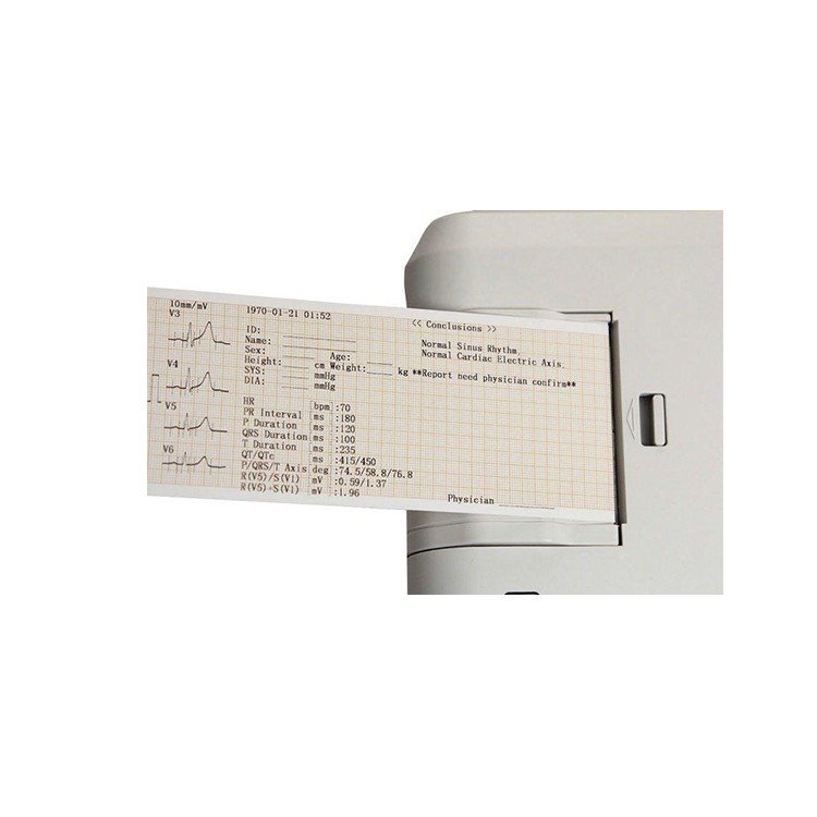 ECG300G Electrocardiograph