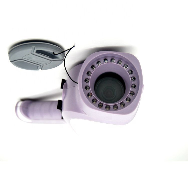 Portable Gynaecology Digital Colposcope System MDLCE07