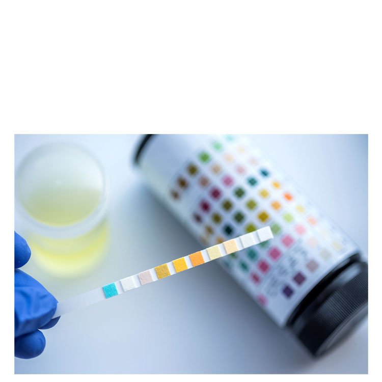 Open Reagent Urine Analyzer Machine MDLBW01