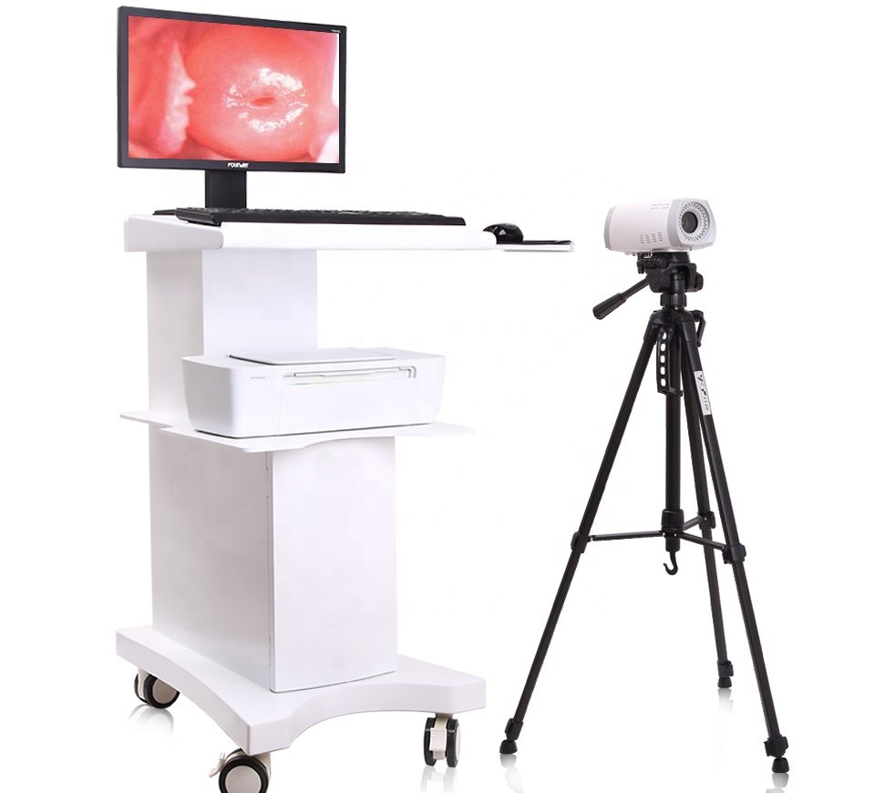 Colposcope Video Machine for Gynaecology MDLCE06
