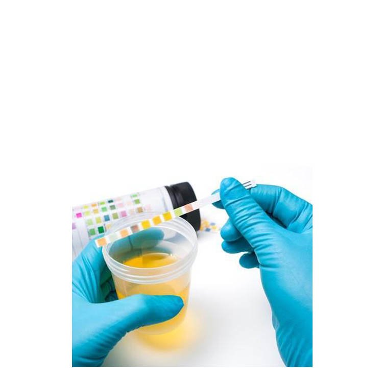 Open Reagent Urine Analyzer Machine MDLBW01