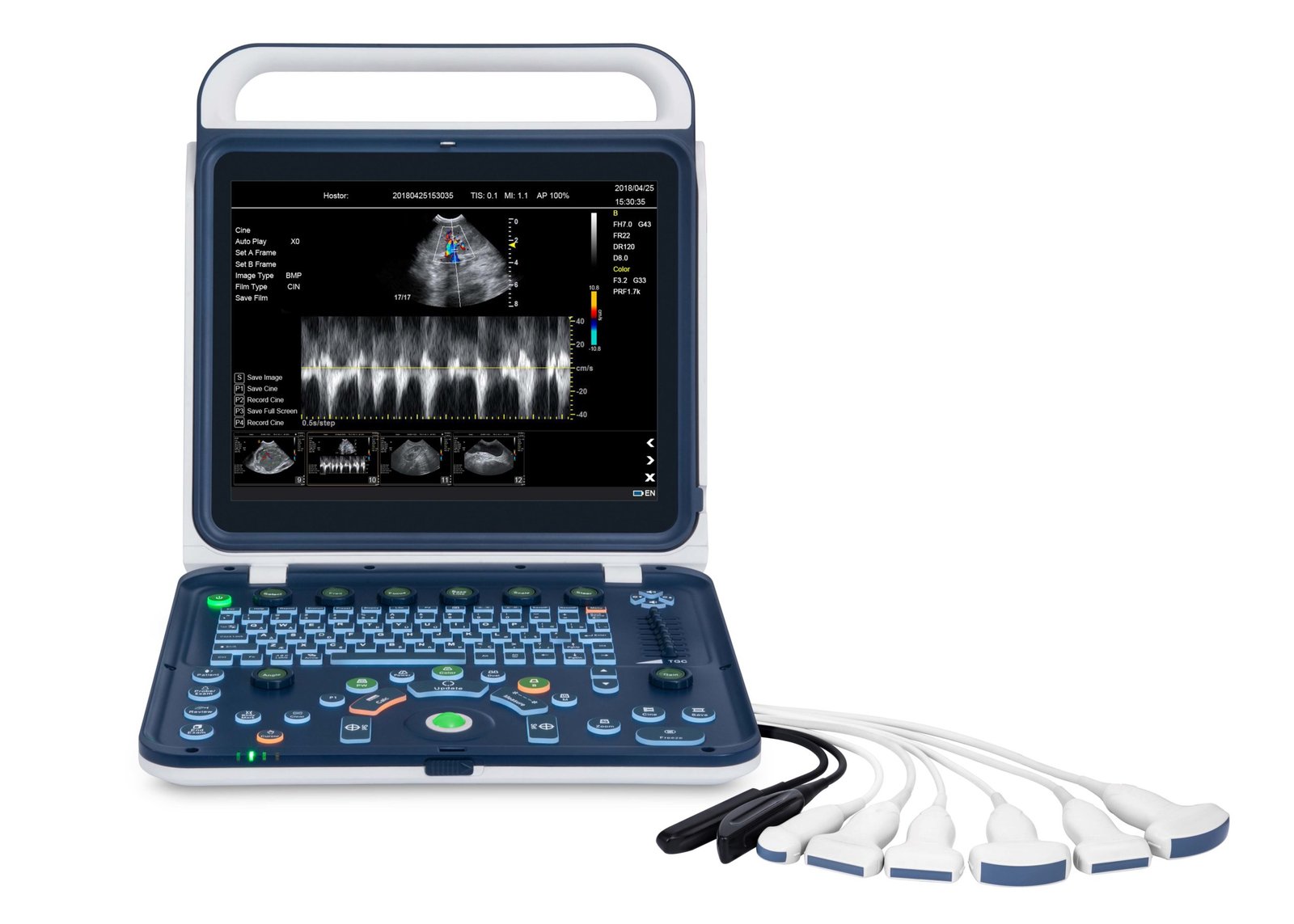 Hand Carried Color Doppler Ultrasound Machine For Vet MDLVU41