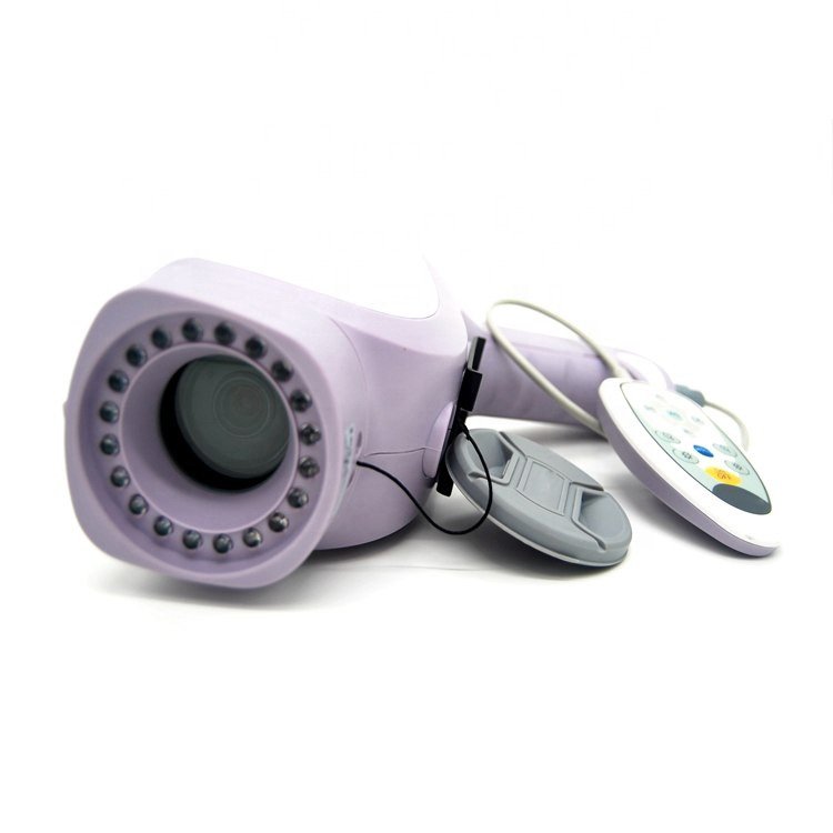 Portable Gynaecology Digital Colposcope System MDLCE07