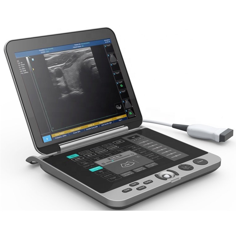 Laptop Ultrasound Machine with Touch Screen Keyboard MDLPU44