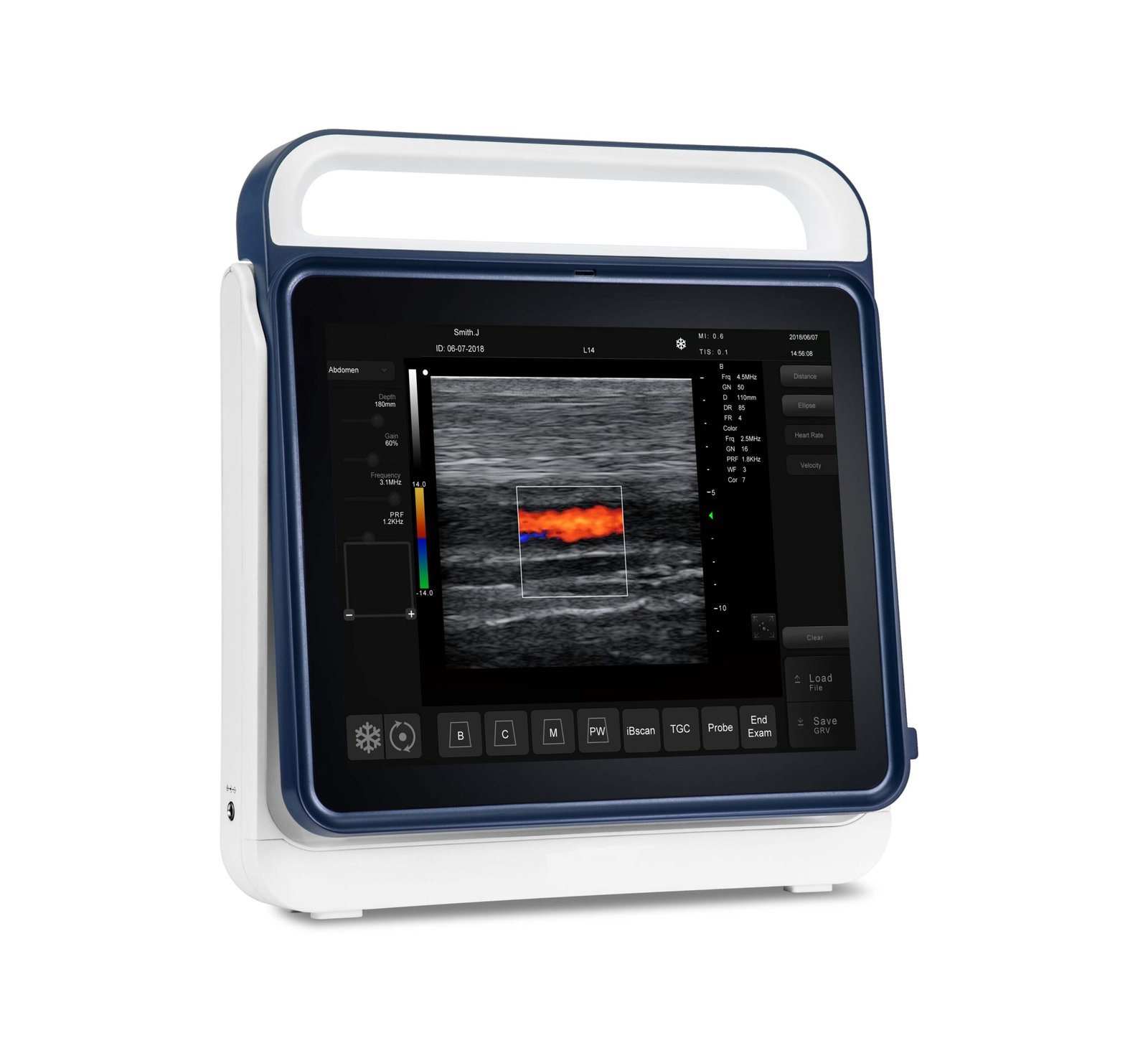 Pad Touch Veterinary Series Ultrasound System Machine MDLVU45