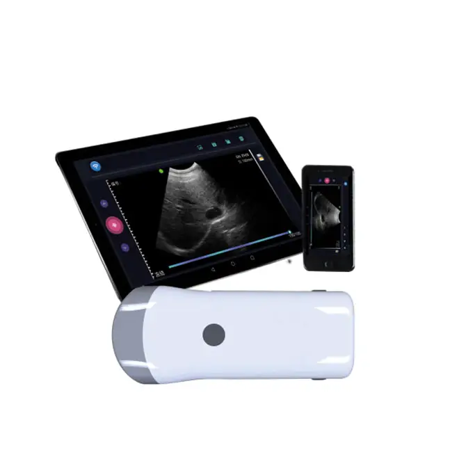 Wifi Portable Ultrasound Scanner Machine MDLVU49