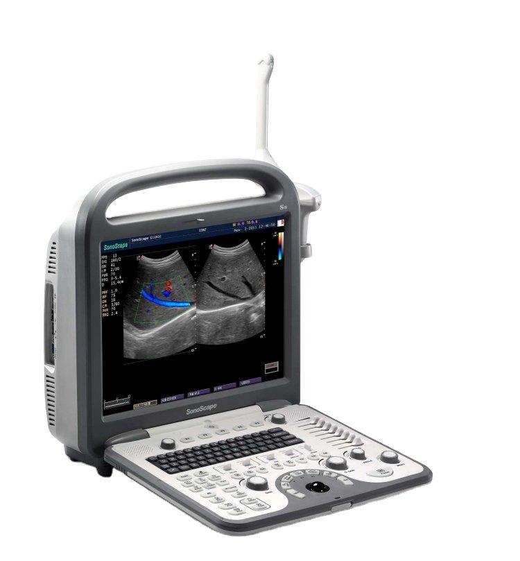 4D Cardiac Stress Color Doppler Ultrasound SonoScape S8