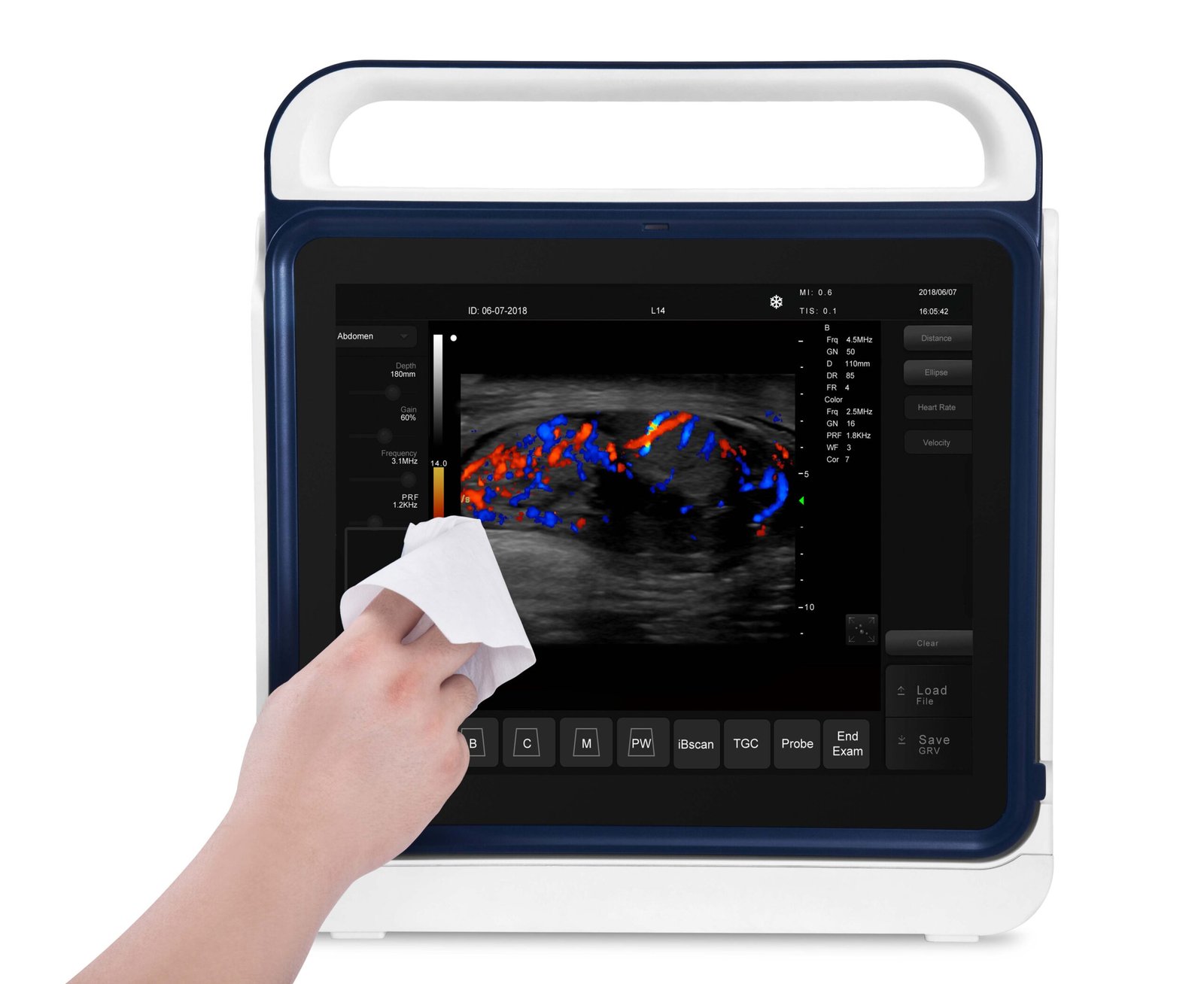 Pad Touch Veterinary Series Ultrasound System Machine MDLVU45