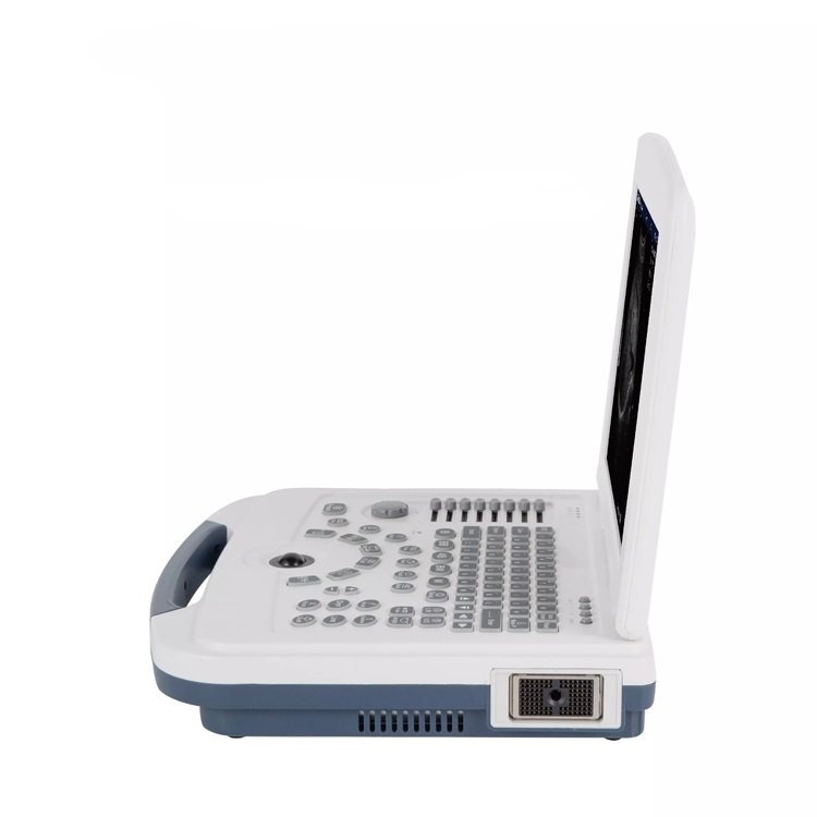 First-Class Digital Imaging B/W Ultrasound Machine MEK-580