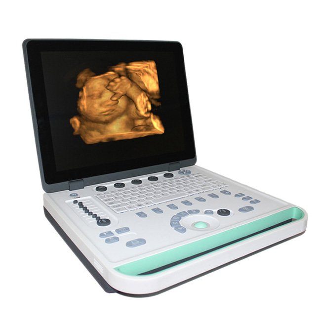 3D Laptop Ultrasound Machine MDLPU34