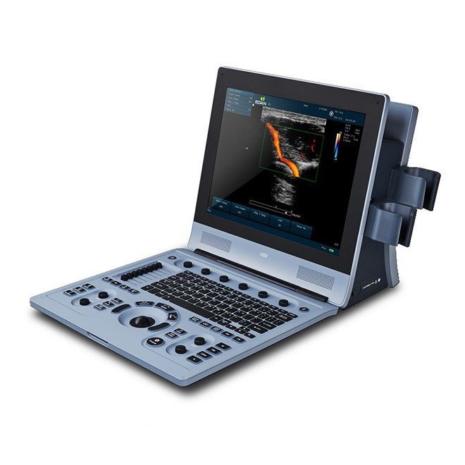 Diagnostic Ultrasound System U60