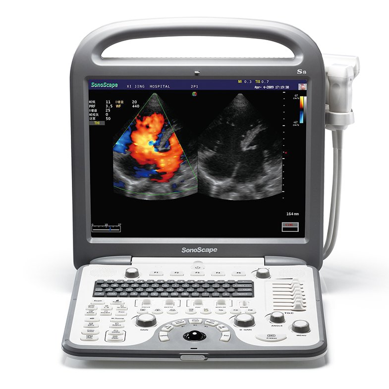 4D Cardiac Stress Color Doppler Ultrasound SonoScape S8