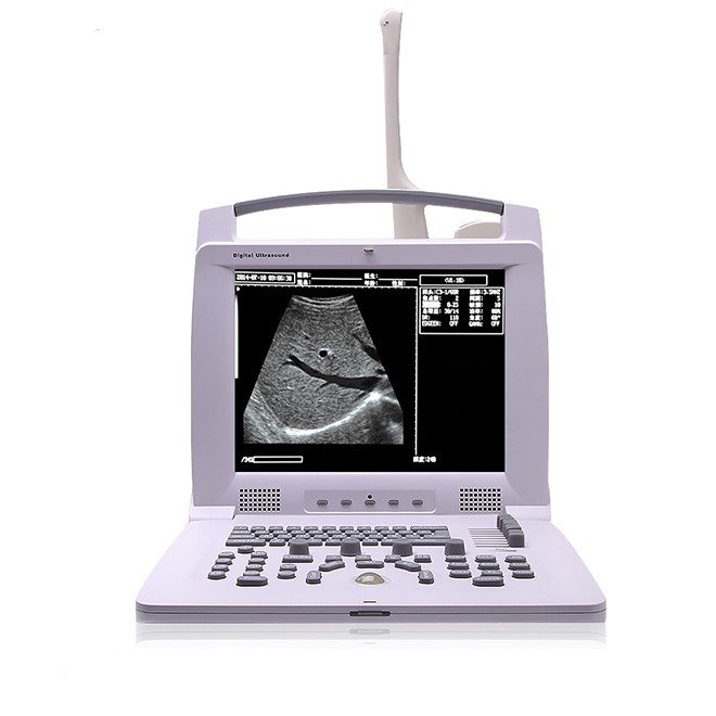 Portable Ultrasound Scanner MDLPU49