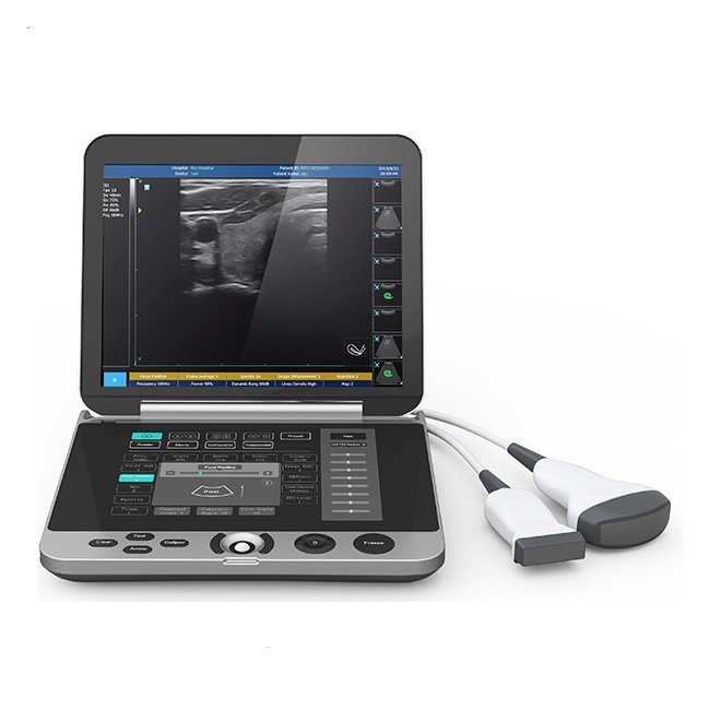 Laptop Ultrasound Machine with Touch Screen Keyboard MDLPU44