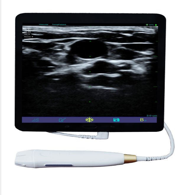 Portable Mini Ultrasound Machine MDLMU09