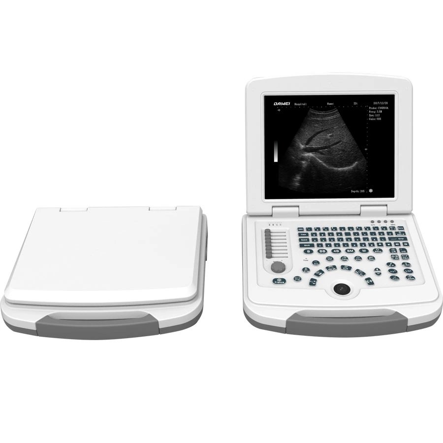 First-Class Digital Imaging B/W Ultrasound Machine MEK-580