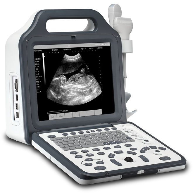 Handheld Wireless Mini B & Color Doppler Ultrasound Scanner MDLPU51