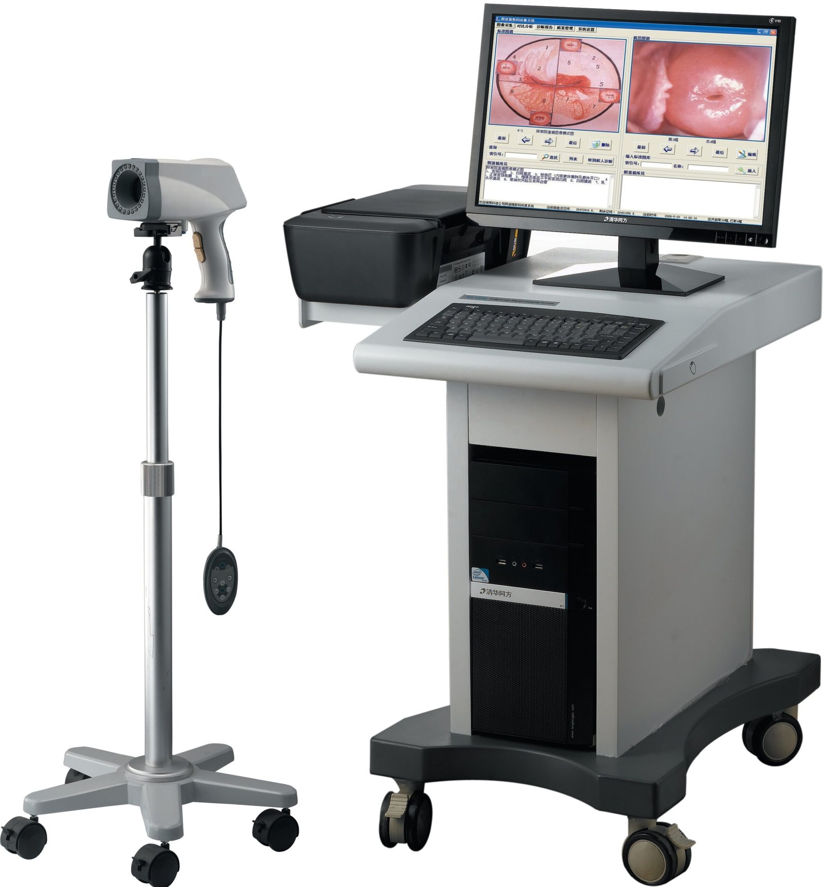 Colposcope Video Machine for Gynaecology MDLCE06