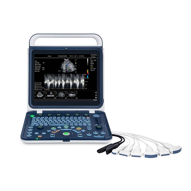 Hand Carried Color Doppler Ultrasound Machine For Vet MDLVU41