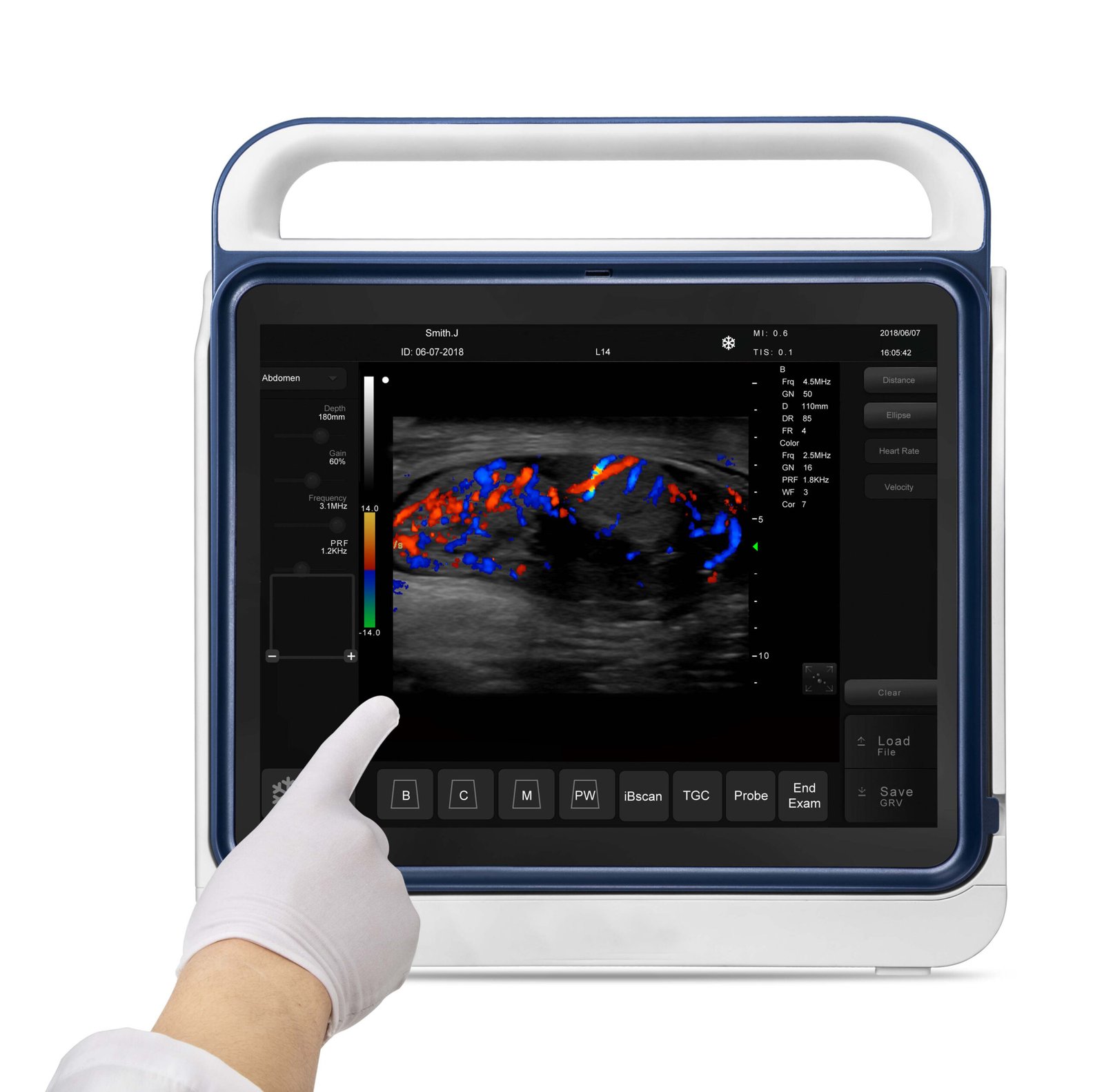 Pad Touch Veterinary Series Ultrasound System Machine MDLVU45