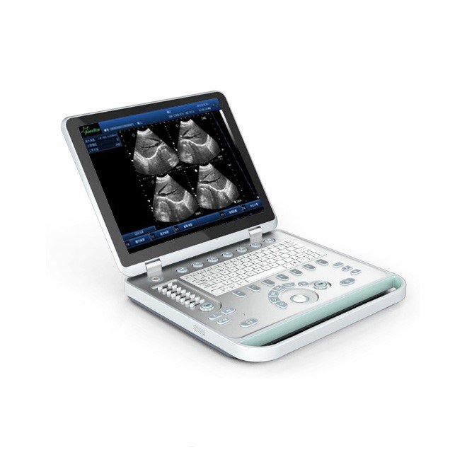 3D Full Digital Laptop Ultrasound Scanner MDLPU25