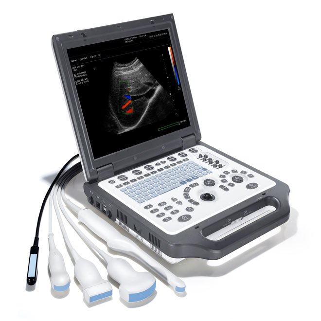 Color Ultrasound Machine with Cardiac Probe MDLCU52