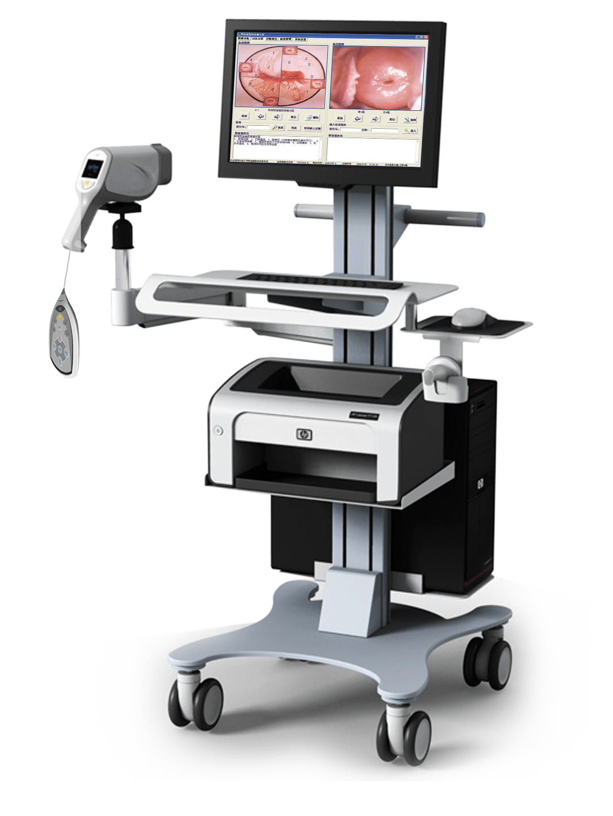 Multi-functional Trolley Colposcope Video Machine MDLCE08