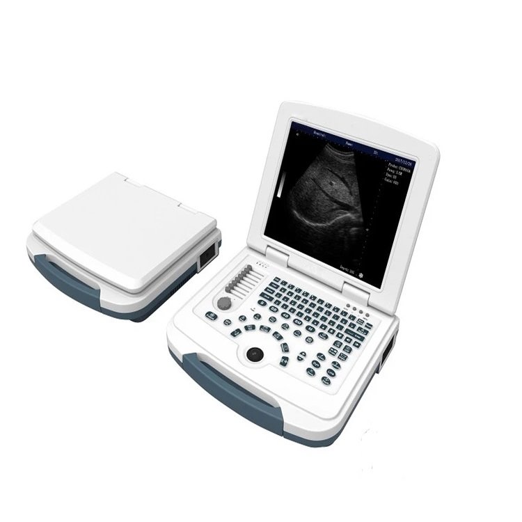 First-Class Digital Imaging B/W Ultrasound Machine MEK-580