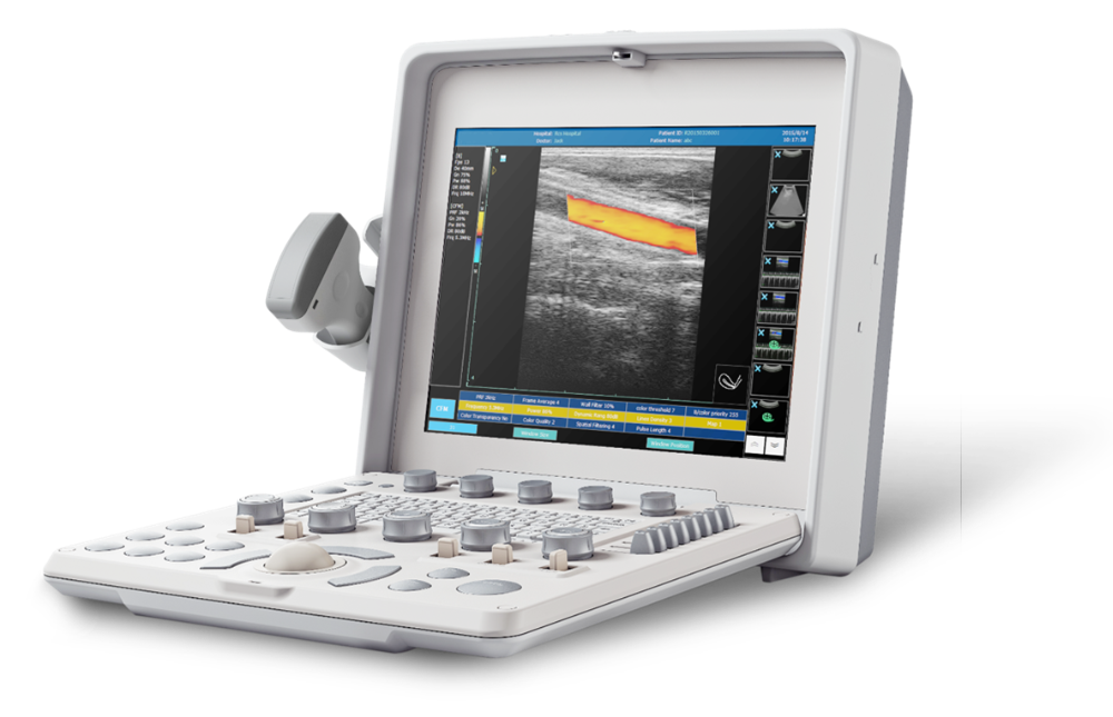 Color Doppler Ultrasound MDLCU36