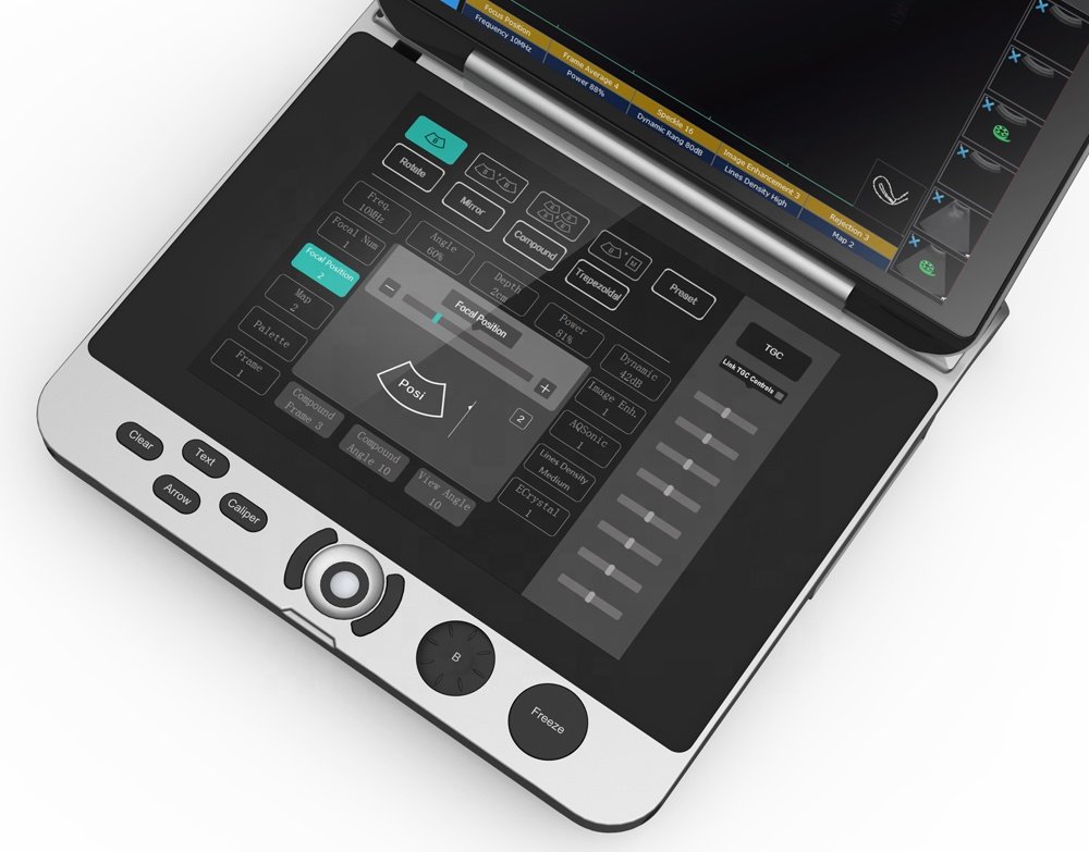 Laptop Ultrasound Machine with Touch Screen Keyboard MDLPU44