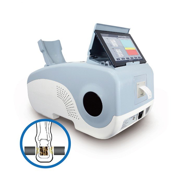 Bone Density Scan MDLBD05