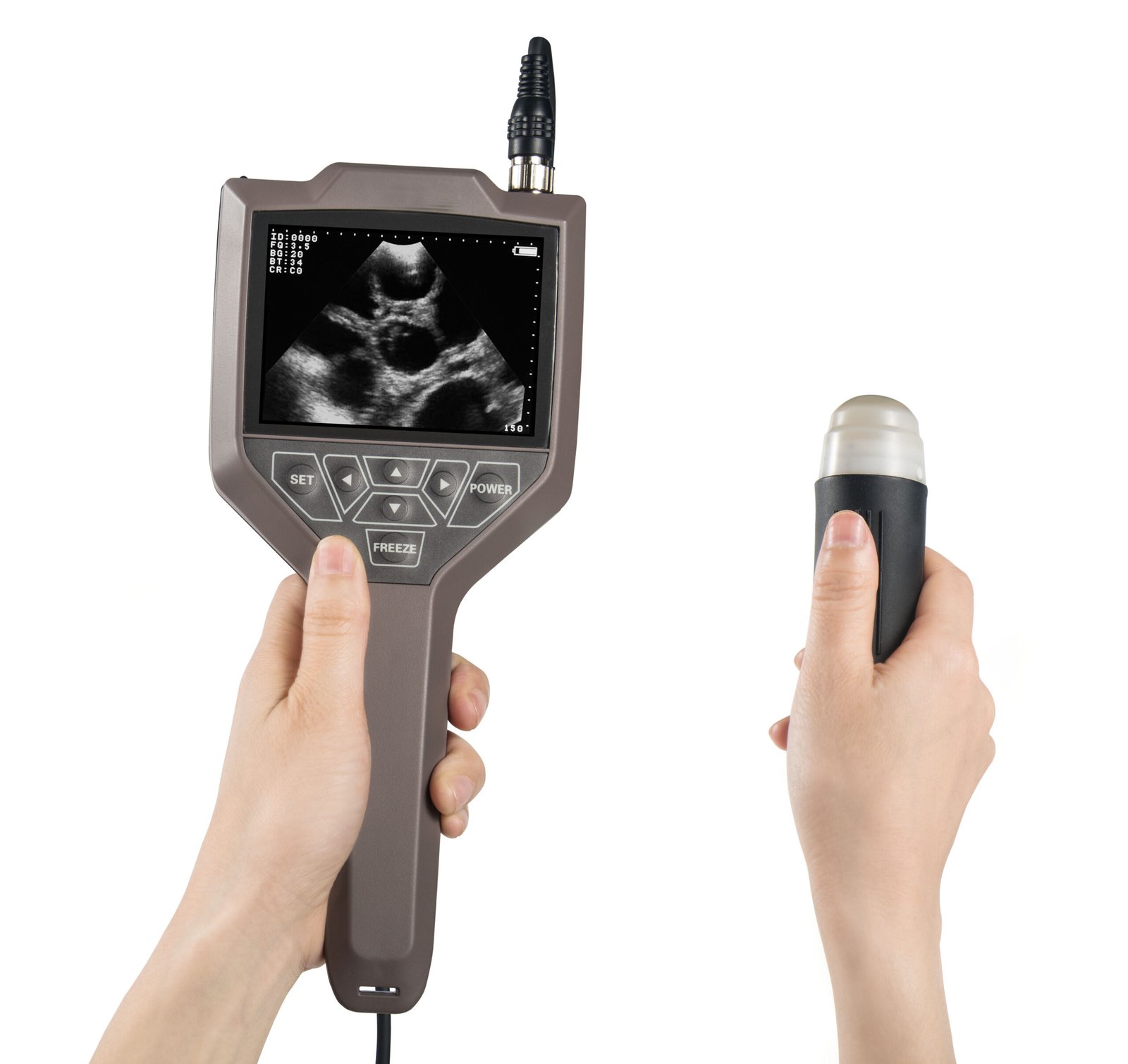 Full Digital Swine And Ovine Ultrasound Scanner Machine MDLVU43