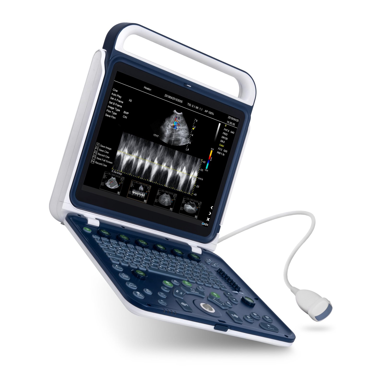 Hand Carried Color Doppler Ultrasound Machine For Vet MDLVU41
