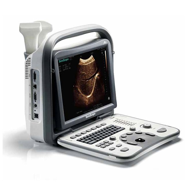 Portable Ultrasound SonoScape A5