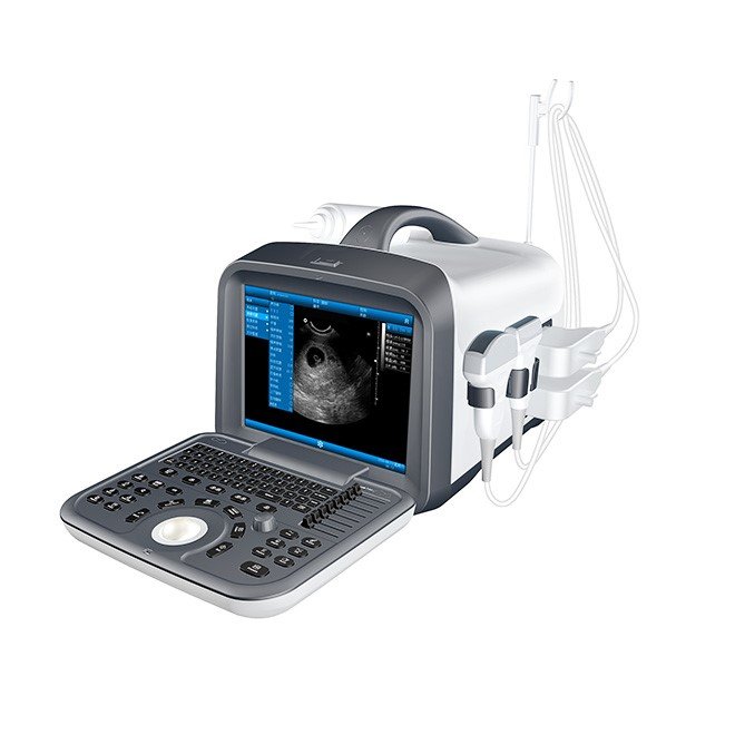 Ultrasonic Diagnostics System MDLPU45