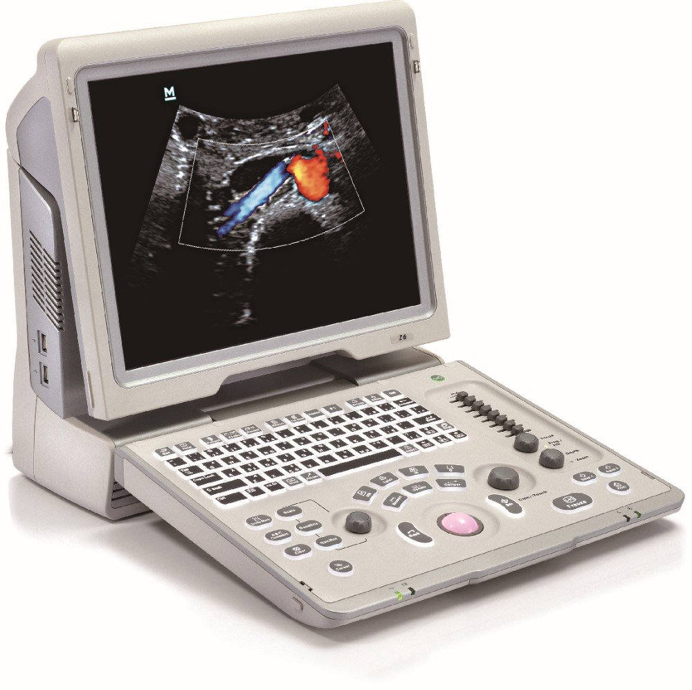 Digital Ultrasonic Diagnostic Imaging System Portable Color Doppler Mindray Z6
