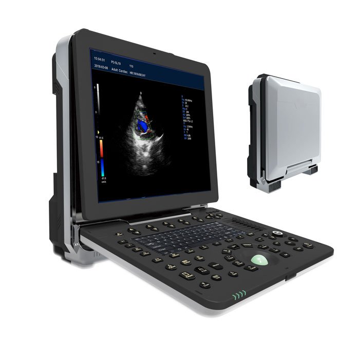 Professional Laptop 4D Color Ultrasound Scanner MDLCU64