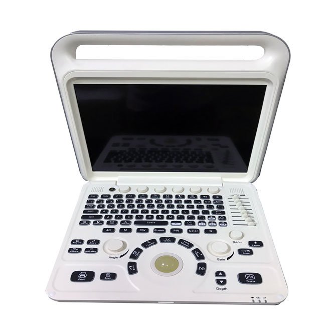 Portable Color Doppler System MDLCU60