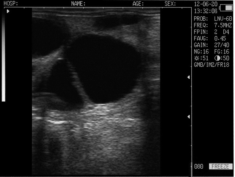 Mini Portable Veterinary Black and White Ultrasound Machine MDLVU42