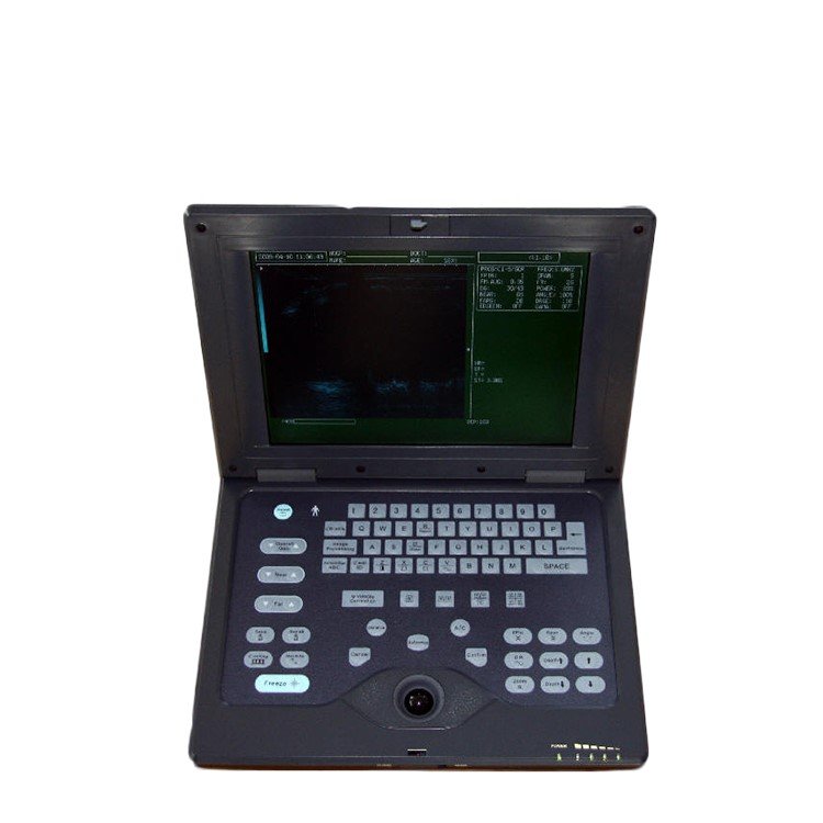 CMS600P B-Ultrasound Diagnostic System