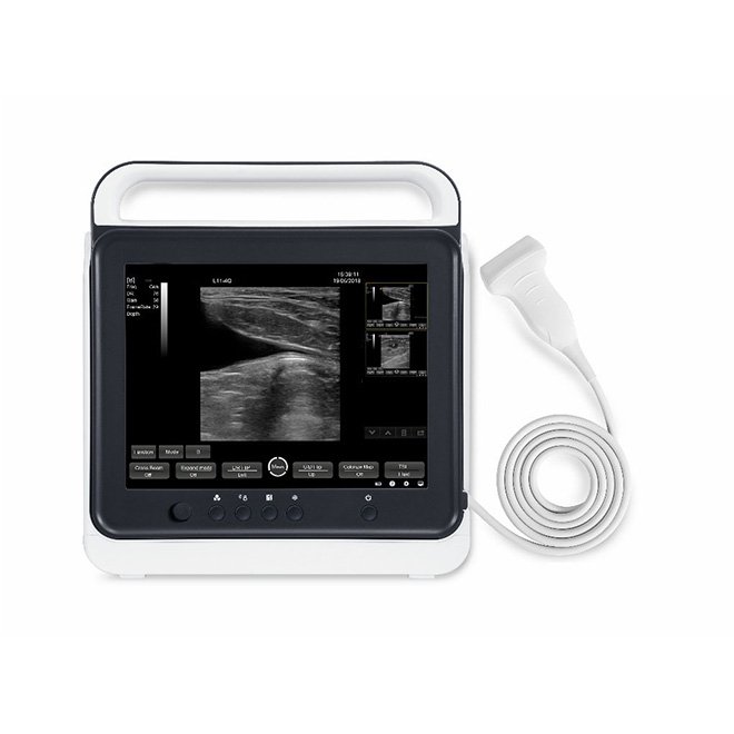 Portable Touch Screen Veterinary Ultrasound Scanner Machine MDLVU40