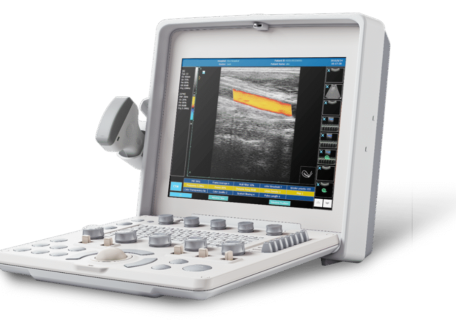 Color Doppler Ultrasound MSLCU36