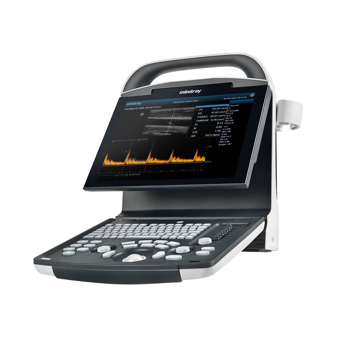 Mindray DP-10 Portable Ultrasound Machine