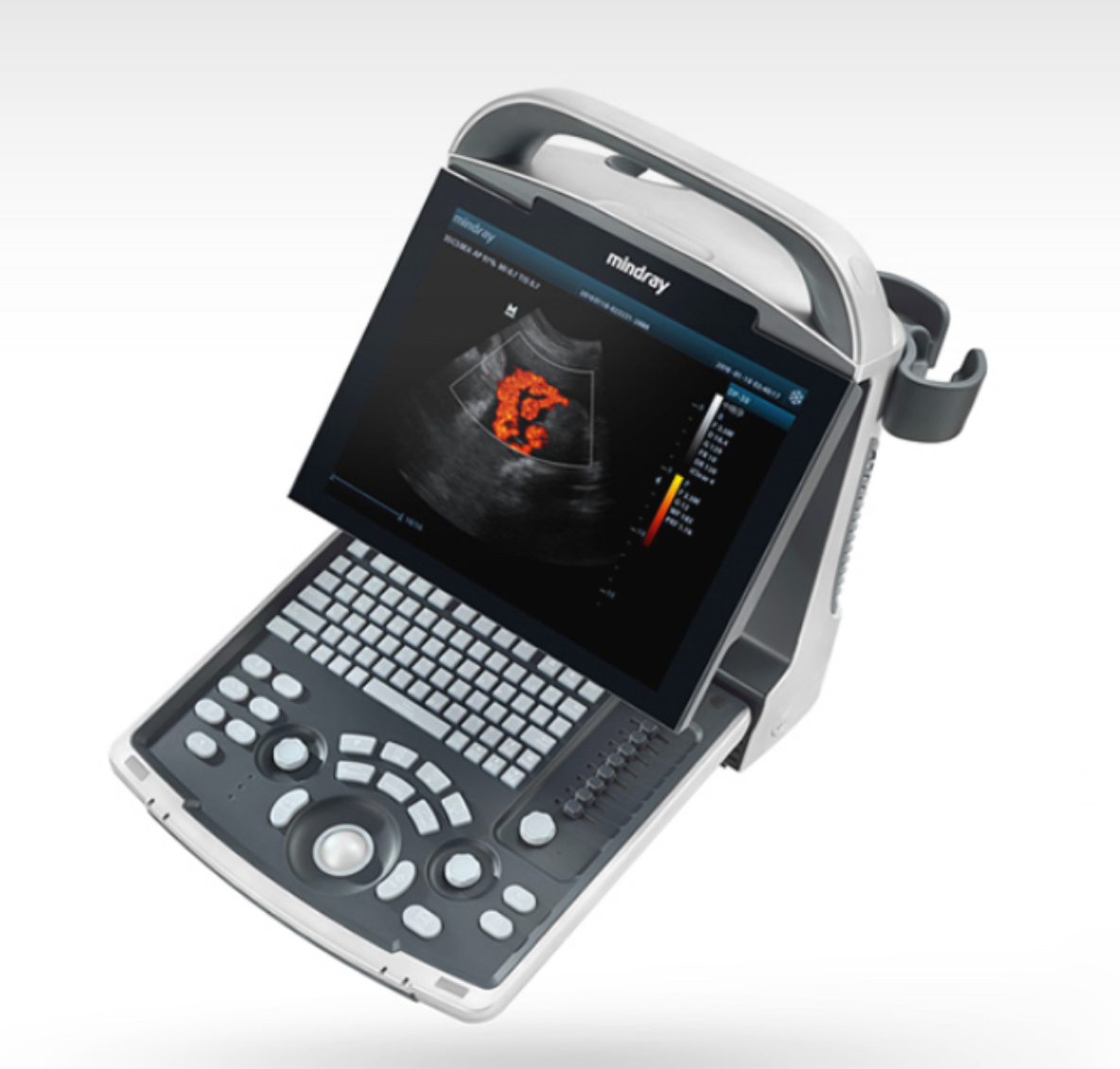 Mindray DP-30 Ultrasound Machine - Detail View